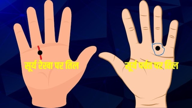 हाथ के सूर्य पर्वत पर तिल होना शुभ या अशुभ? करियर की बाधाओं से लेकर पद-प्रतिष्ठा पर असर तक
