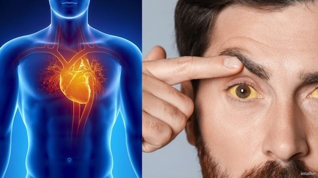 दिल की बीमारियों से जुड़े अनसुने और हैरान करने वाले राज